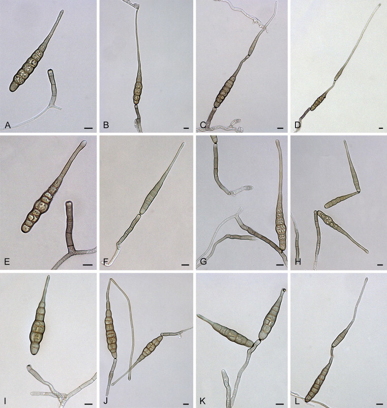 Alternaria crassa: conidia and conidiophores.