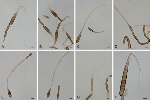 Alternaria solani conidia and conidiophores.