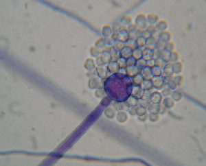 Backusella circina