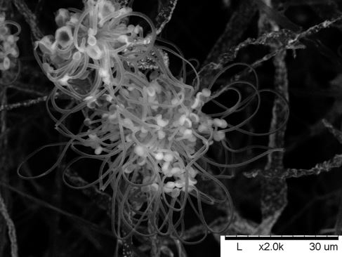 Sporangiola forming at the apex of two sporangiophores, 2000x.
Image courtesy of Derreck Carter-House.