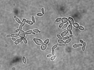 Photo of Candida tenuis NRRL Y-1498 v1.0