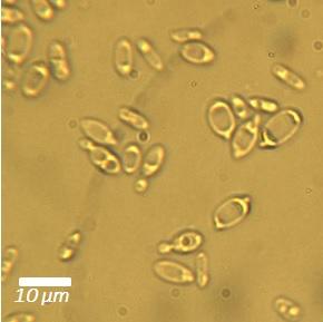 Cryptococcus curvatus ATCC 20509