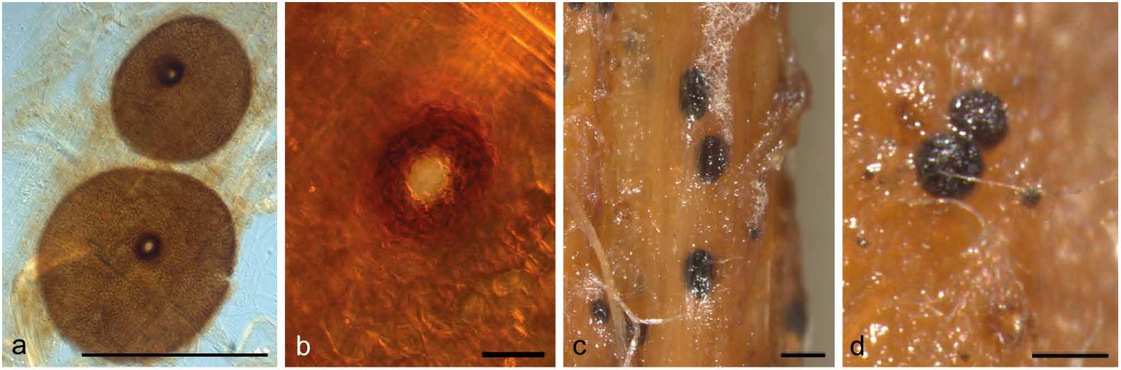 Ascus and ascospores of Darksidea gamma.