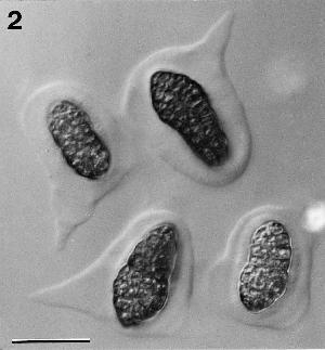 Decorospora gaudefroyi ascospores surrounded by hyaline sheaths.