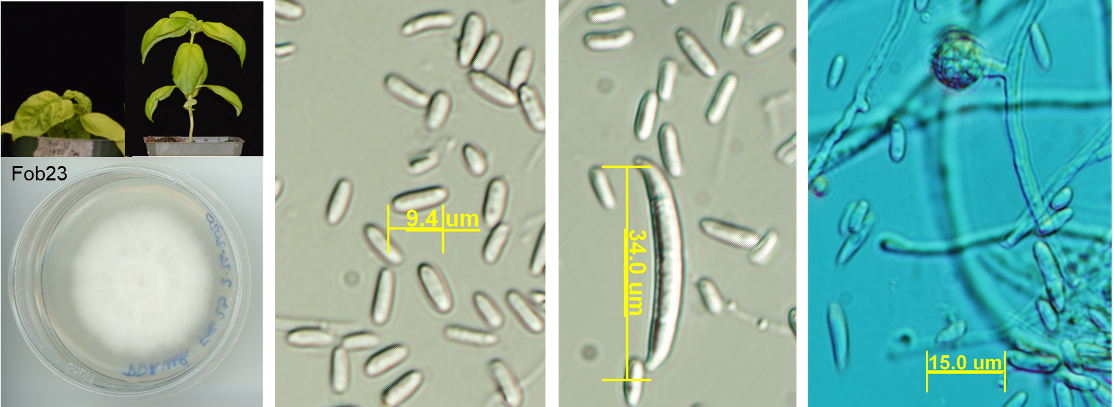 Fusarium oxysporum f.sp. basillici responsible for the basil fusarium vascular wilt.