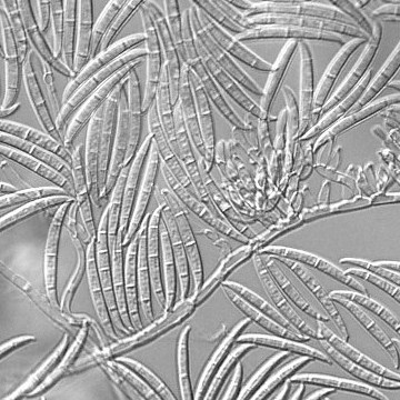 Macroconidia of Fusarium graminearum.