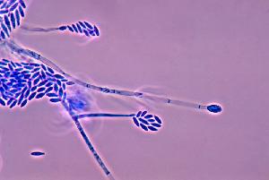 Photomicrograph showing the conidiophores and conidia of Fusarium verticillioides.