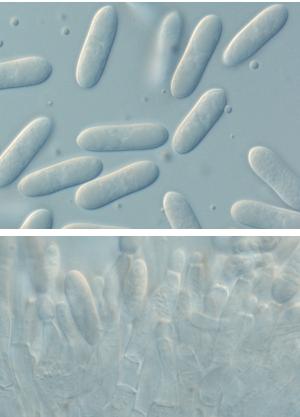 Photo of Glomerella cingulata 23 (Colletotrichum gloeosporioides 23) v1.0