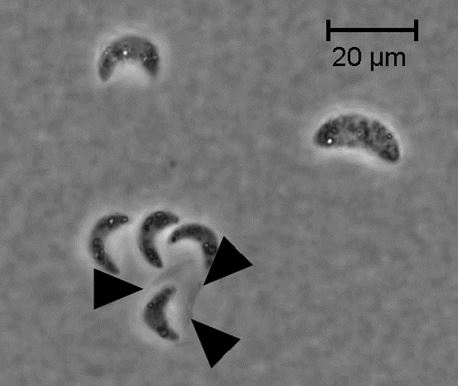 Hyaloraphidium curvatum SAG235-1. Photo by Joyce E. Longcore.