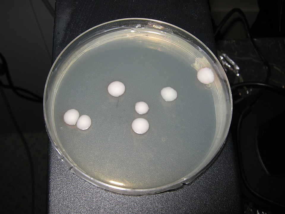 Kluyveromyces marxianus colonies on lactose selective agar. Image generated by <a
href="https://commons.wikimedia.org/wiki/User:Ude">Ude</a>
and available under the <a
href="http://creativecommons.org/licenses/by-sa/3.0/">Creative
Commons SA 3.0 License</a>.