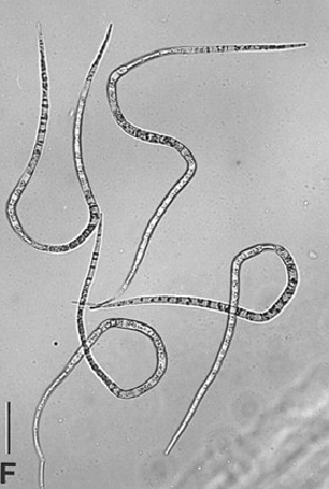 Lindra thalassiae ascospores. Spatafora, Volkmann-Kohlmeyer and Kohlmeyer, 1998