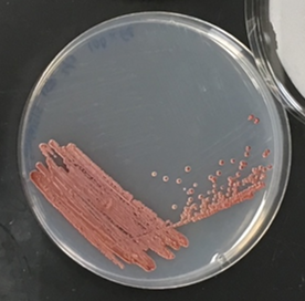 Metschnikowia sp. yHQL305 growth on artificial media. Image by David Krause. 