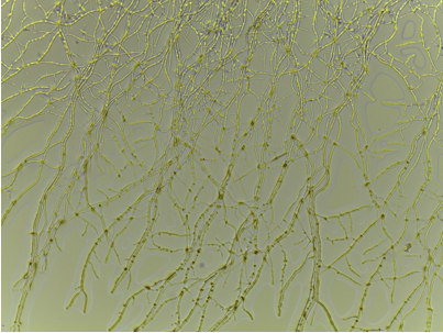 Figure 1. Mycelial network of Mortierella gamsii. Image courtesy of Julian Liber.