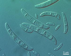 Macroconidia and microconidia of Fusarium vanettenii