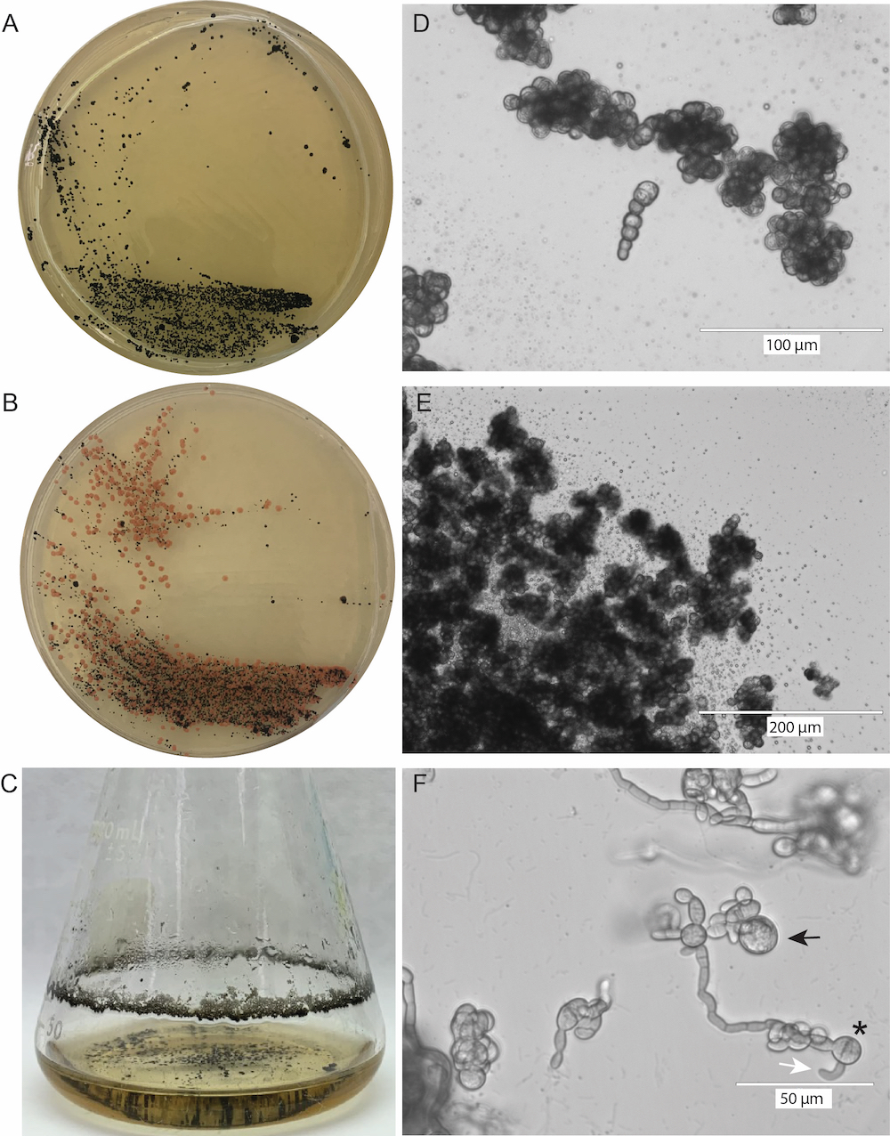 Neophaeococcomyces sp. JF2 08-2F Crusty