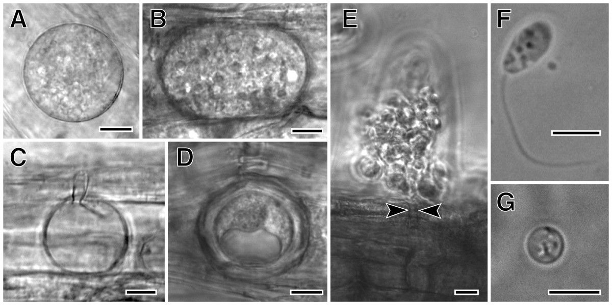 From Sekimoto et al., 2011: Olpidium bornovanus, a unicellular
fungus, is an obligate parasite of plants that reproduces with
flagellated, swimming zoospores. A-B. Vegetative unicellular thalli
in cucumber root cells. Thalli differentiate into sporangia with
zoospores, or into resting spores. C. An empty sporangium, after
zoospore release. D. A thick-walled resting spore. E. Zoospores
being released from a sporangium, showing the sporangium exit tube
(arrowheads). F. A swimming zoospore with a single posterior
flagellum. G. An encysted zoospore. Bars: A-E = 10 &mu;m; F,G = 5
&mu;m. Figures are from <a
href="https://bmcevolbiol.biomedcentral.com/articles/10.1186/1471-2148-11-331">Sekimoto et.
al., 2011</a> used under a <a
href="http://creativecommons.org/licenses/by/2.0/">Creative Commons
Attribution 2.0</a> License.