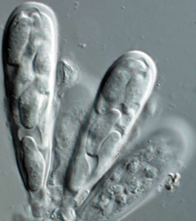 Asci with ascospores.