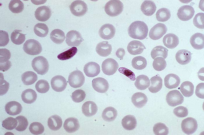 Plasmodium falciparum