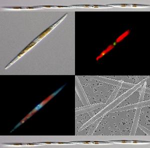 Pseudo-nitzschia multiseries 