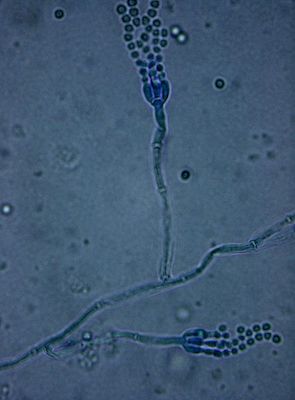 Penicillium spp. under bright field microscopy (10 x 100 magnification) with lactophenol cotton blue stain. Photo credit: Dr. Sahay. CC BY-SA 3.0 via Wikimedia Commons