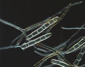 Photo of Pyrenophora tritici-repentis