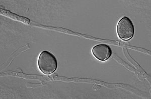 R. toruloides teliospores