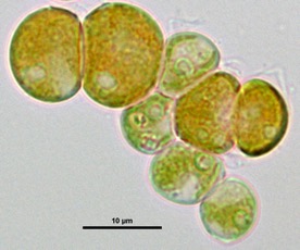 Scenedesmus sp. NREL 46B-D3