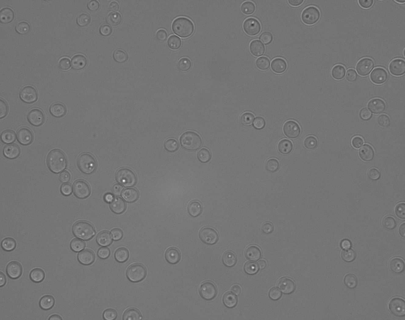 Spathaspora suhii UFMG-HMD-16.2. Photo credit: Katharina Barros, David Krause, Chris Hittinger.