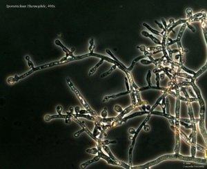 Photo of Sporotrichum thermophile v1.0