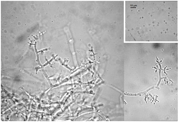 Photo of Trichoderma atrobrunneum ITEM 908