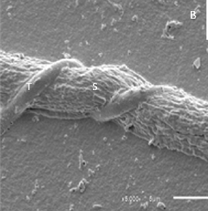 Photo of Trichoderma harzianum TR274 v1.0