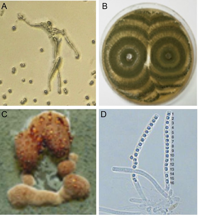 Photo of Trichoderma reesei QM6a