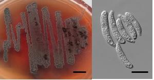 Ustilaginomycotina sp. SA807 culture on potato dextrose agar (left) and cell morphology from potato dextrose broth (right)