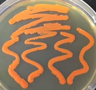 Xanthoyphyllomyces dendrorhous ATCC 96594. Image by Joseph Collins.