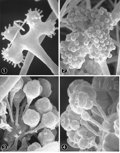 Figure 1) Multi-lobed branched, lateral sporangiophores. Figures
2-4) Globose, ovoid sporangioles and swollen columnella. Images by
Kerry O'Donnell