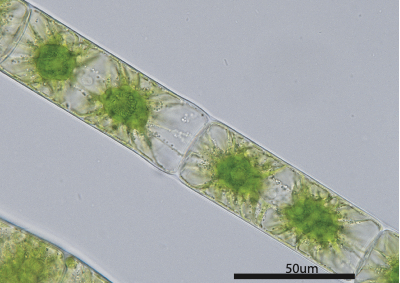 Zygnema cf. cylindricum SAG 698-1a [Image credit: Xuehuan Feng]