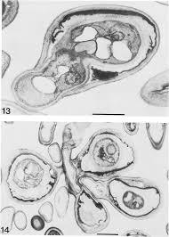 Zygoascus hellenicus from Smith 1986.